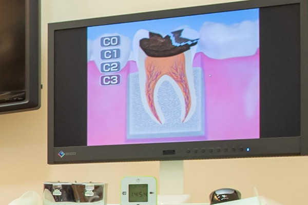 アニメーションを使ったわかりやすい説明