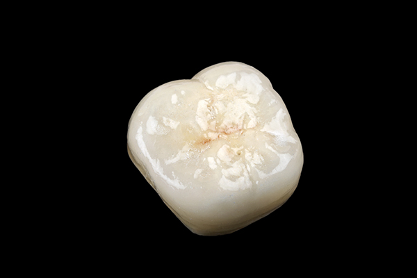 セラミックとは？