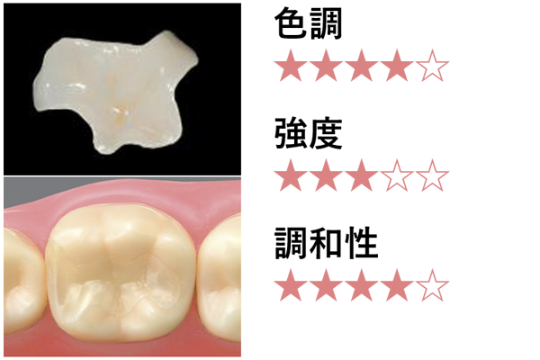 セラミックインレー