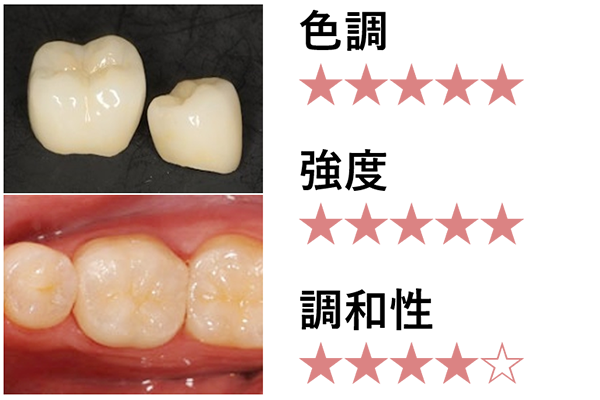 ジルコニアセラミッククラウン