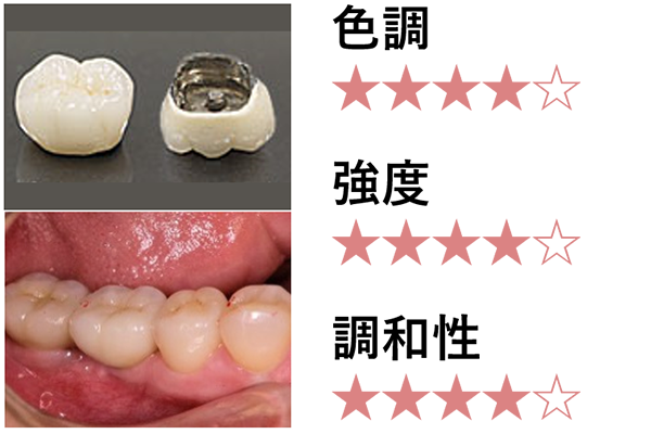 メタルボンドクラウン