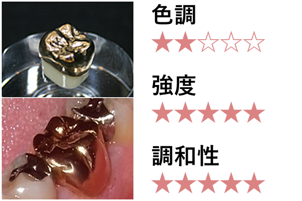 ゴールドクラウン