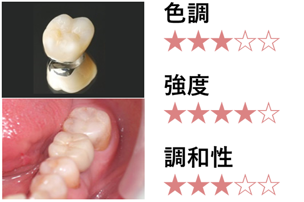 ハイブリットセラミッククラウン