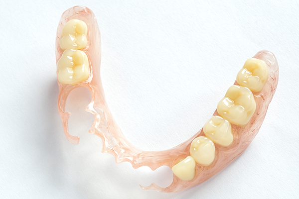 ノンクラスプデンチャー