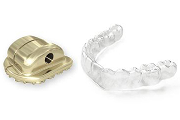 エスガイド矯正